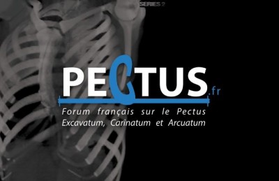 test pectus4(1).JPG